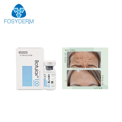 100 Einheiten schreiben einen Botulinumgiftstoff Allergan, das Antigesichtsbehandlung Einspritzung  Botulax knittert