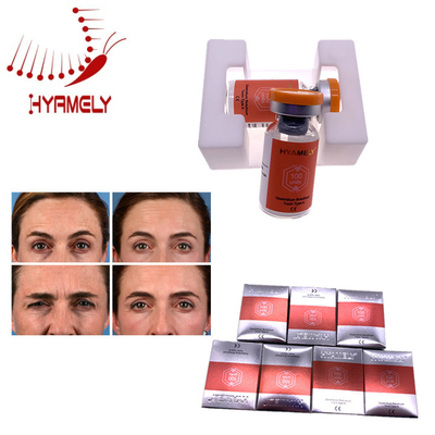 Gute Effekt-alternde Botulinumgiftstoff-Antieinspritzung Hyamely 100 Einheiten