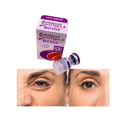 Das Entfernen der Gesichtsbehandlung zeichnet Botulinumeinheiten Allergan o des giftstoff-100