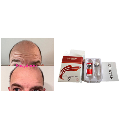 Hyamely 100 Einheiten Botulinumtoxin Anti Falten Neues Produkt  Injektion