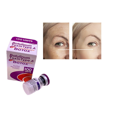 100 Einheiten Allergan--Injektion beseitigt feine Gesichtslinien