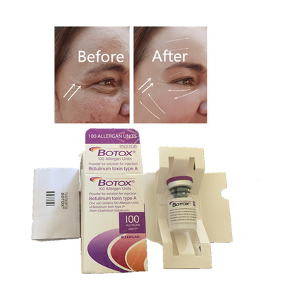 100 Einheiten Allergan--Injektion beseitigt feine Gesichtslinien