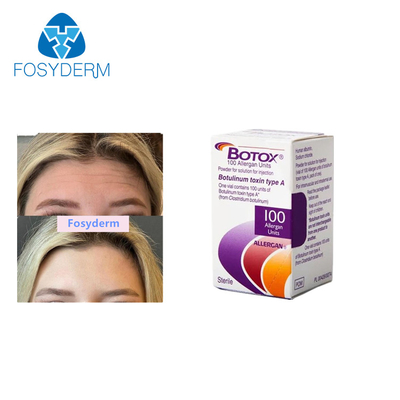 Entfernen Sie Falten Injektion Allergan Botulinum Toxin  Typ A 100 Einheiten