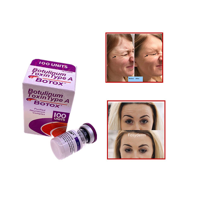 Allergan Botulinum Toxin  100 Einheiten Entfernen Falten Injektion