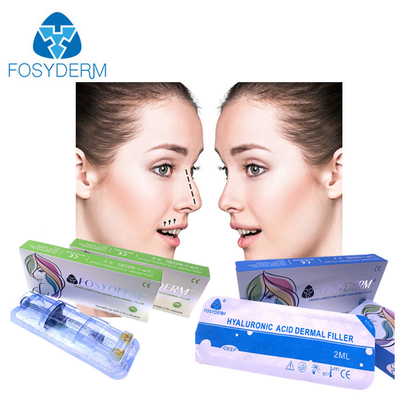 Fosyderm 2 ml Hyaluronsäure Hautfüllmittel für Gesichtsfalten Lippen Kinn Wangen