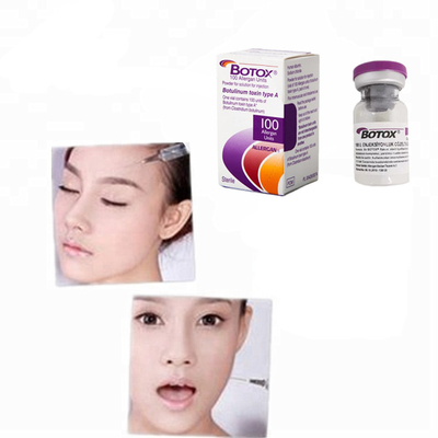 Botulinumtoxin 100iu 200iu Allergan  Pulver Injektion Botulax