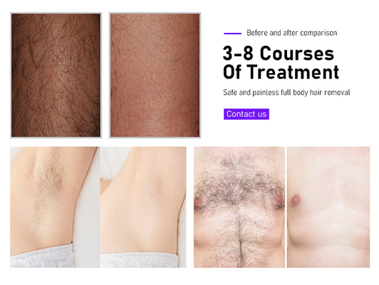 Schönheitsgeräte Fosyderm Laser-Haarentfernung Maschine 3 Wellen 12 Stäbe