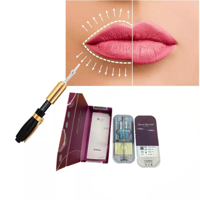Juvederm Hyaluronsäure Hautfiller 2 ml Lippenvergrößerung Gesichtsfiller