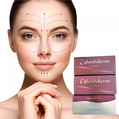 Juvederm Hyaluronsäure Hautfiller 2 ml Lippenvergrößerung Gesichtsfiller