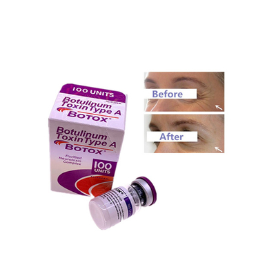 Unlöslich in Wasser Allergan 100 Einheiten Botulinumtoxin perfekt für die Herstellung
