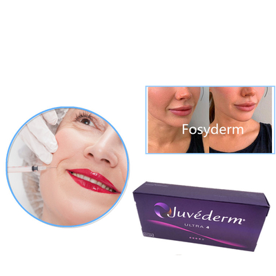 2 × 1 ml Volumen Hyaluronsäure Hautfiller Die perfekte Lösung für schnelle Erholungszeit