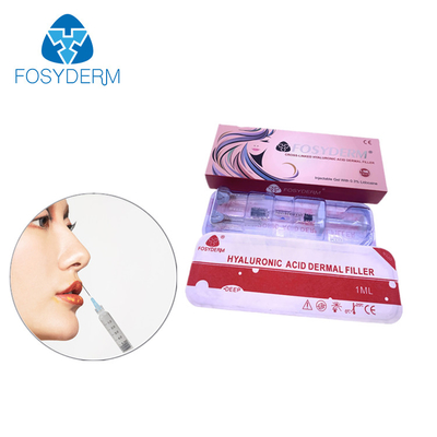 2 ml Hyaluronsäure Hautfüllmittel zur Faltenglättung im Gesicht, Kinn, Wange, Lippen und Körper