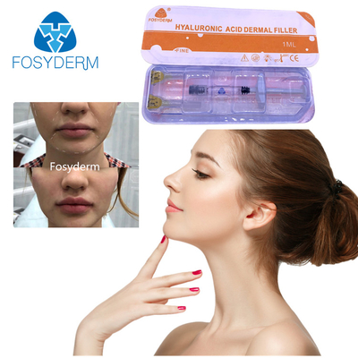 2 ml Hyaluronsäure Hautfüllmittel zur Faltenglättung im Gesicht, Kinn, Wange, Lippen und Körper