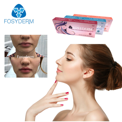 Gel 1 ml Hyaluronsäure-Füllmittel zur Faltereduzierung und Gesichtsformung