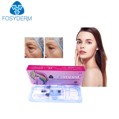 OEM-Hyaluronsäure-Füllmittel für dicke und strahlende Haut