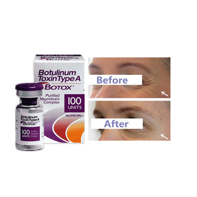 100 Einheiten pro Injektion Botulinumtoxin Geruchlose und professionelle Stärke-Injektionen