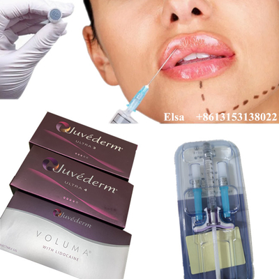 Juvederm Ultra4 Voluma Hautfüllmittel gegen Falten Hyaluronsäure-Injektion für das Gesicht