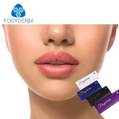 Derm-Kreuz verband Hyaluronsäure-injizierbares Lippenfüller 1ml 2ml CER-ISO-Zertifikat