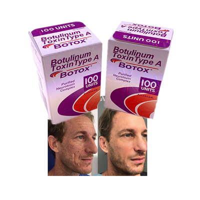 Allergan Botulinum Toxin Pulver zur Fermentationsherstellung