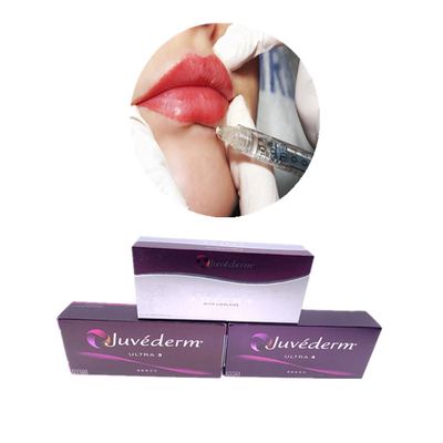 Juvederm Hyaluronsäure für Lippen, Wange und Kinn