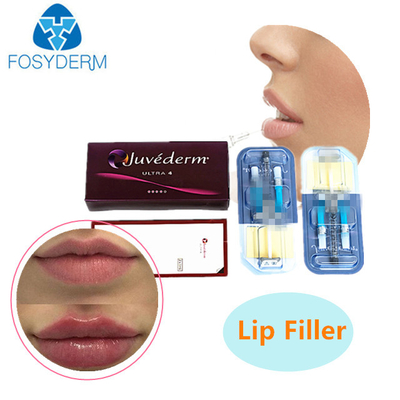 2 ml Hyaluronsäure Filler für die Haut JUVEDERM Injektionsgel Faltenfiller