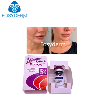 Weißes reines Pulver Botulinumtoxin mit hoher Toxizität und einer Haltbarkeit von 2 Jahren
