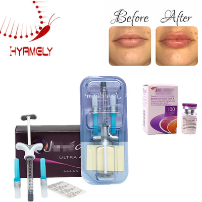 Allergan Injektions Botulinum Toxin Anti- Falten Filler für Gesicht und Hals Faltenreduzierung Lösung
