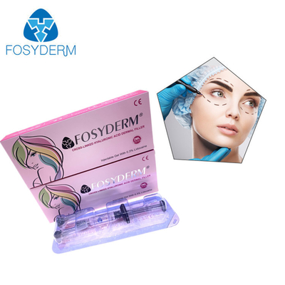 Hyaluronsäure Filler 24 mg/ml für Gesicht Lippen Wange Kinn