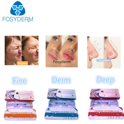 Hyaluronsäure-Füllmittel 1 ml-50 ml für Gesicht und Körper