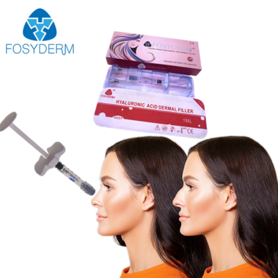 Tiefe Falten Injektion mit Ultra 4 Fosyderm Deep 1ml 2ml HA Hautfiller
