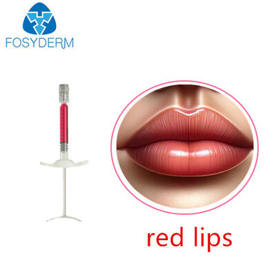 Lippenvolumen mit Vitamin B12, 1 ml, 24 mg/ml Hautfüller, Hyaluronsäure, roter Lippenfüller