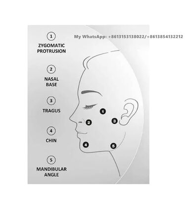 Profhilo 64mg/2ml Hyaluronsäure-Dermalfiller-Injektion Hautpflege