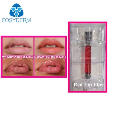 Roter Lippenfüller mit Vitamin-B12-Injektion, Hyaluronsäure-Füller, Schönheits-Lippenvergrößerung, 1 ml