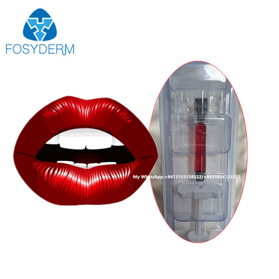 Roter Lippenfiller Hyaluronsäure Dermalfüller Injektion mit Vitamin B12 für Lippen 1ml
