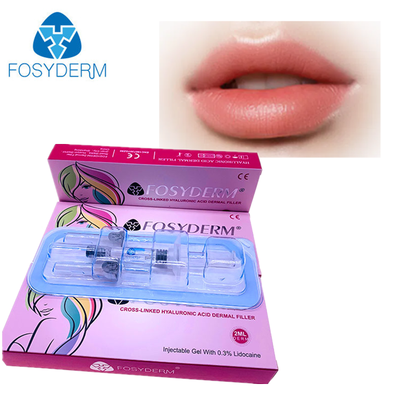 Injectable Hyaluronic Acid Dermal Filler With High Viscosity For Cheeks Chin Nose Lip Volume Correction