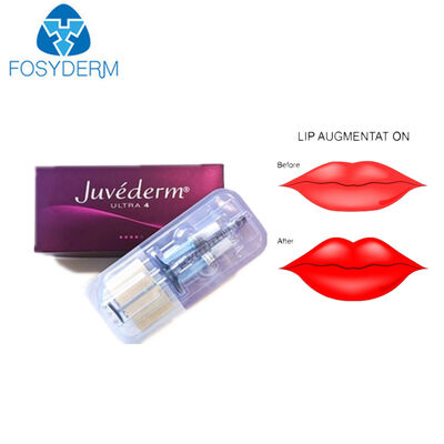 Juvederm Hyaluronic Acid Dermal Filler for Lip Facial Wrinkle