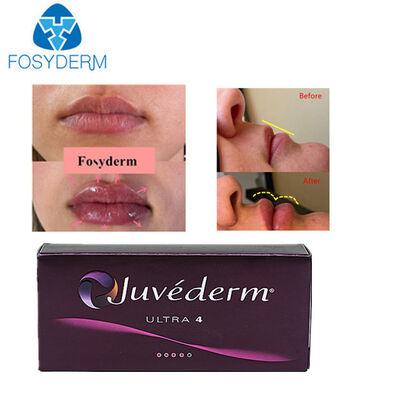 Juvederm Hyaluronic acid dermal filler for Lips Nose Face