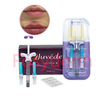 Juvederm Voluma Dermal Filler Mid‑Face Cheek Volume Restoration