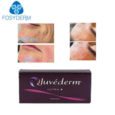 Hyaluronic Acid Dermal Filler Face Lifting Lips Augmentation 2*1ml