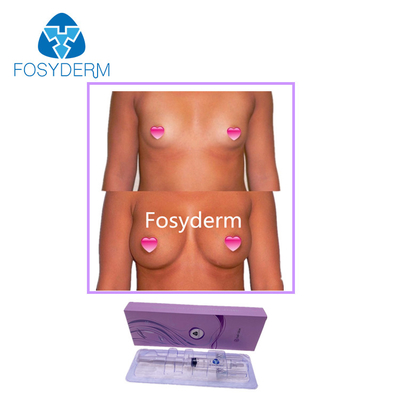 Hyaluronsäure-Hautfüller-Hinterteil Fosyderm 10ml und Brustvergrößerungs-Einspritzung