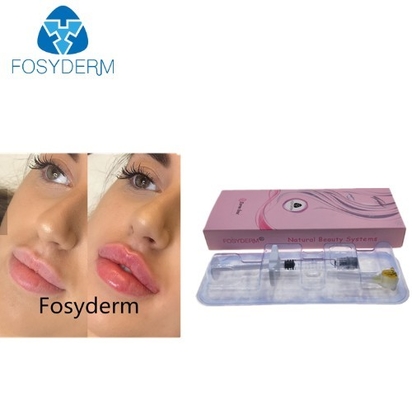 Lippenverbesserungs-Hyaluronic auf Säure basierende Füller, kreuzen verbundene ha-Füller-Einspritzung