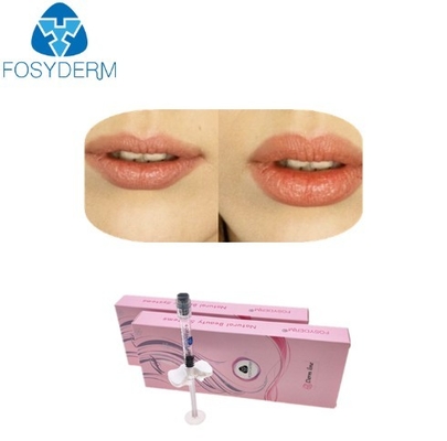 saures Gel 2ml Hyaluronate für Lippen Verbesserung, Hyaluronsäure-injizierbarer Füller