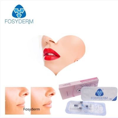 Gelatieren Sie Fosyderm 2ml kreuzen verbundenen Hyaluronsäure-Hautfüller für Lippenverbesserung