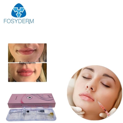 Gelatieren Sie Fosyderm 2ml kreuzen verbundenen Hyaluronsäure-Hautfüller für Lippenverbesserung