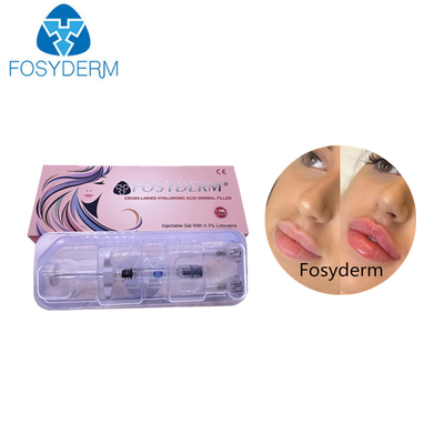 Reines Kreuz Fosyderm 100% verband Hyaluronsäure der Einspritzungs-1ml für Lippenfüller