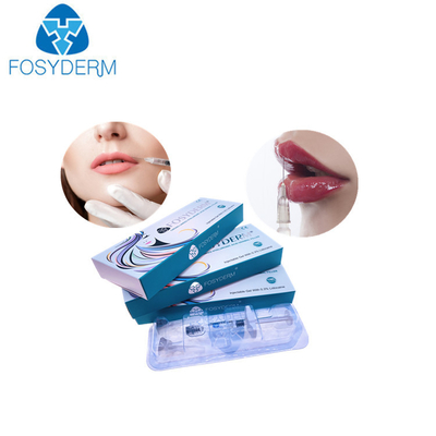 Derm-Lippenverbesserungs-Einspritzung Füller der Hyaluronsäure 1ml Lippenfür Frauen