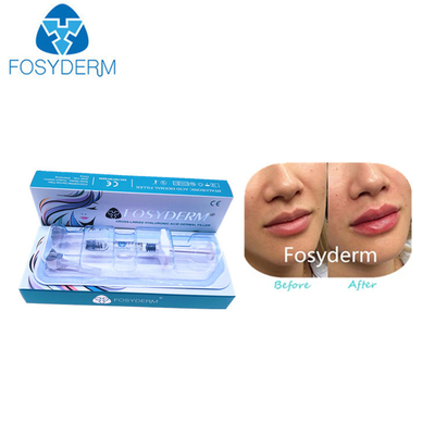 Hyaluronsäure-Hautfüller 1ml Derm für Lippen-CER Bescheinigung