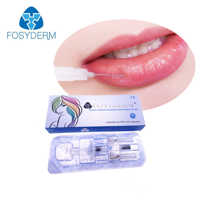 Vernetzungs-Hyaluronsäure-Füller-Einspritzung 2ml injizierbare BDDE für Lippenvolumen