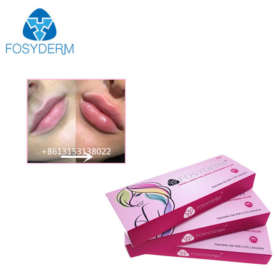 Fosyderm 1 ml Hyaluronsäure Injektionen mit Hautfüllmittel zur Lippenvergrößerung