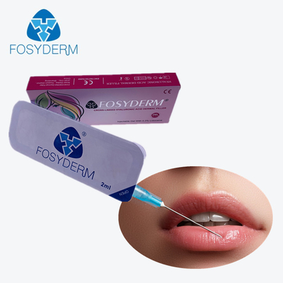 Hyaluronsäure-Hautfüller 2 ml Fosyderm Derm für Lippen und mittlere Falten